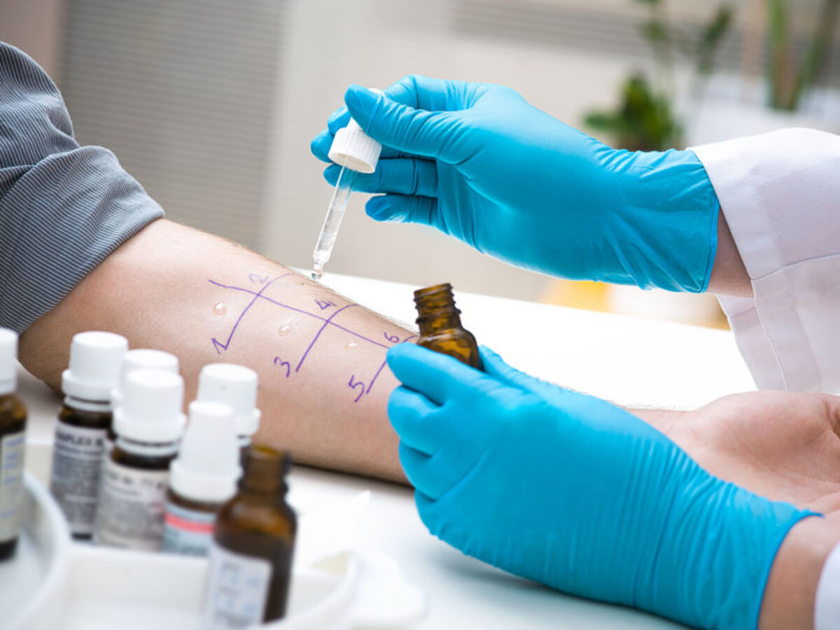 In unserer Hautarztpraxis in Bad Doberan bieten wir unseren Patienten eine ausführliche allergologische Beratung, wenn es um den Umgang mit diagnostizierten Allergien geht.